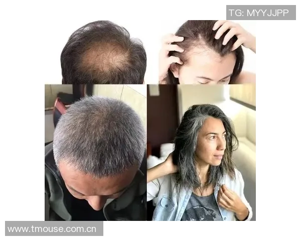 足球明星为何能保持浓密秀发揭秘背后的秘密与护发技巧 足球明星为何能保持浓密秀发揭秘背后的秘密与护发技巧